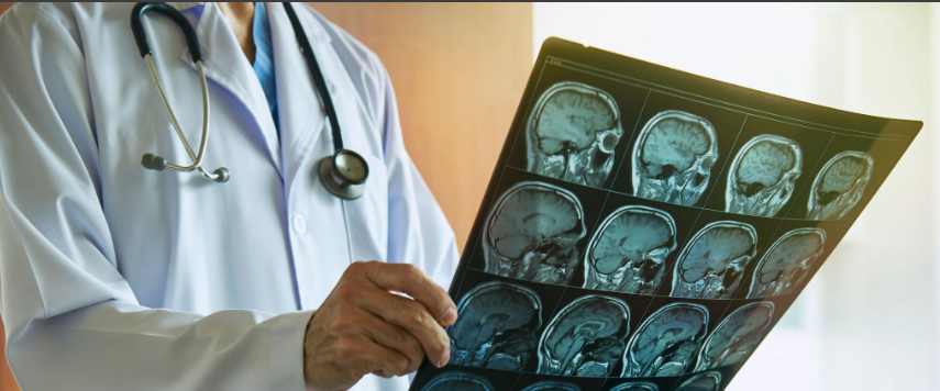 Você está visualizando atualmente Neurocirurgião: Especialista Essencial para a Saúde e o Setor Empresarial.